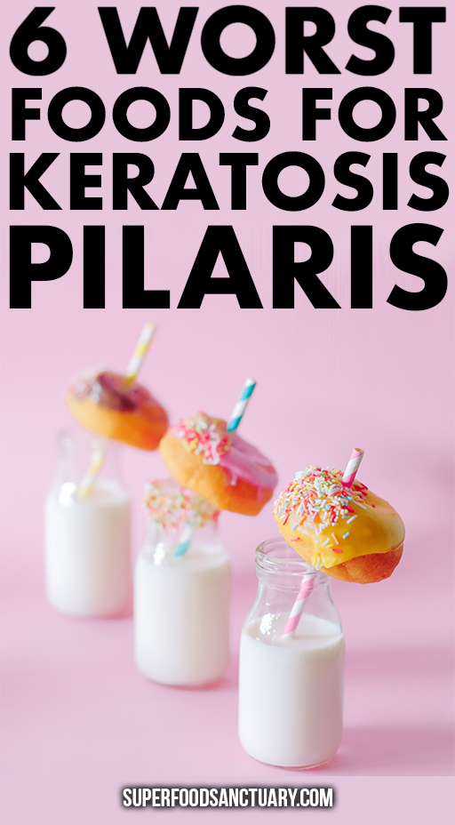 Keratosis pilaris (KP) is also known as ‘chicken skin.’ It mainly affects the upper arms, back of thighs, back of legs, buttocks, scalp and even the face. In this article, find out the list of foods to avoid if you have keratosis pilaris!