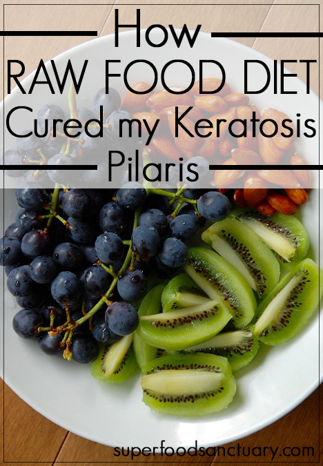 Have you got keratosis pilaris, also known as chicken skin? I will show you how raw food diet cured my keratosis pilaris and you can try it out too!
