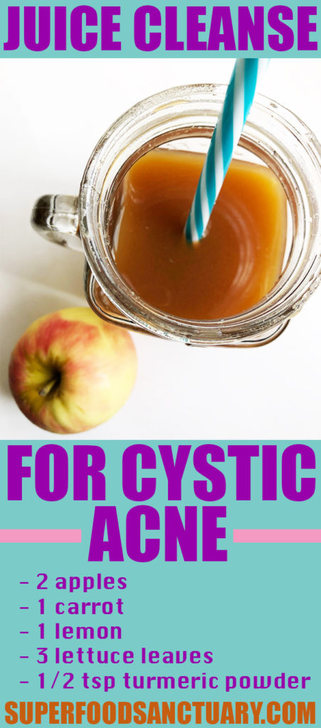 Have you ever tried a juice cleanse for cystic acne? If you haven’t, then you must try it out to help clear your cystic acne!