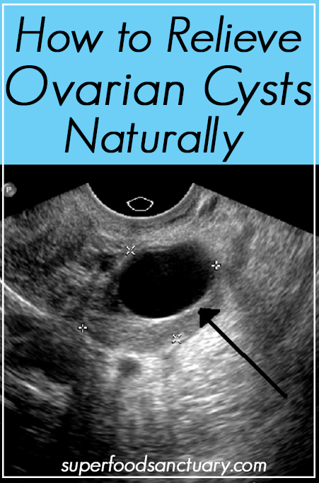 If you’re searching for how to relieve ovarian cyst pain naturally, this article will help you out. 