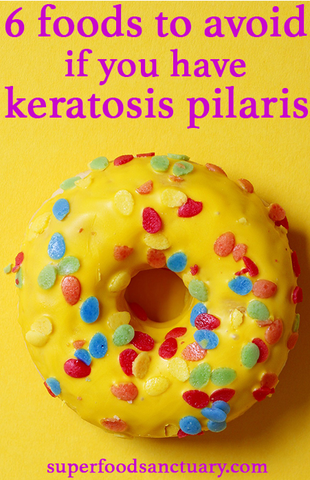 Here are 6 foods to avoid if you have keratosis pillars