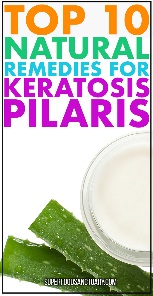 Please use these natural remedies for keratosis pilaris – they actually work!  ﻿