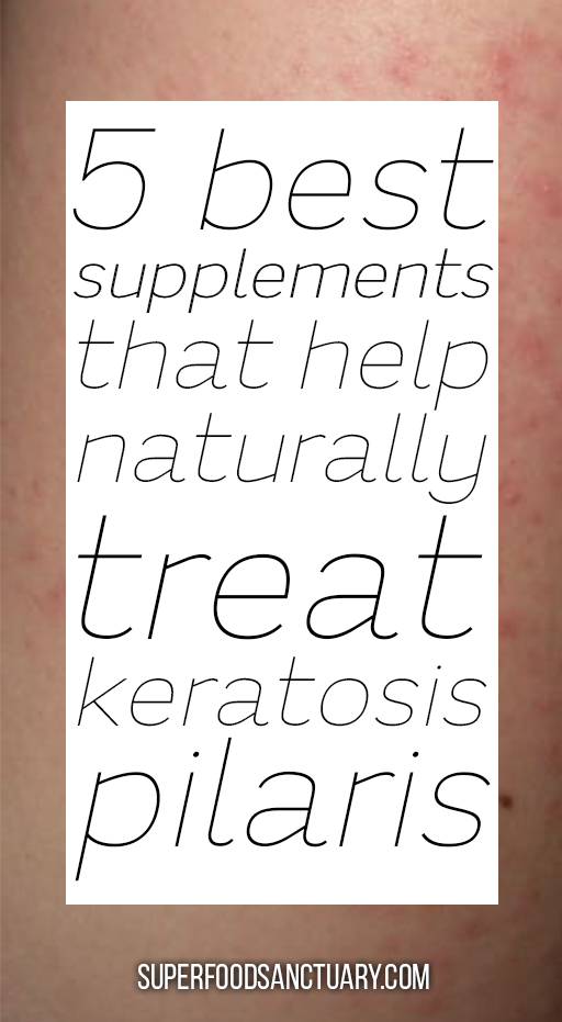 Keratosis pilaris also known as chicken skin is a very frustrating skin problem to deal with. Let’s see 5 helpful supplements that treat keratosis pilaris and helps you achieve smoother clearer skin! 