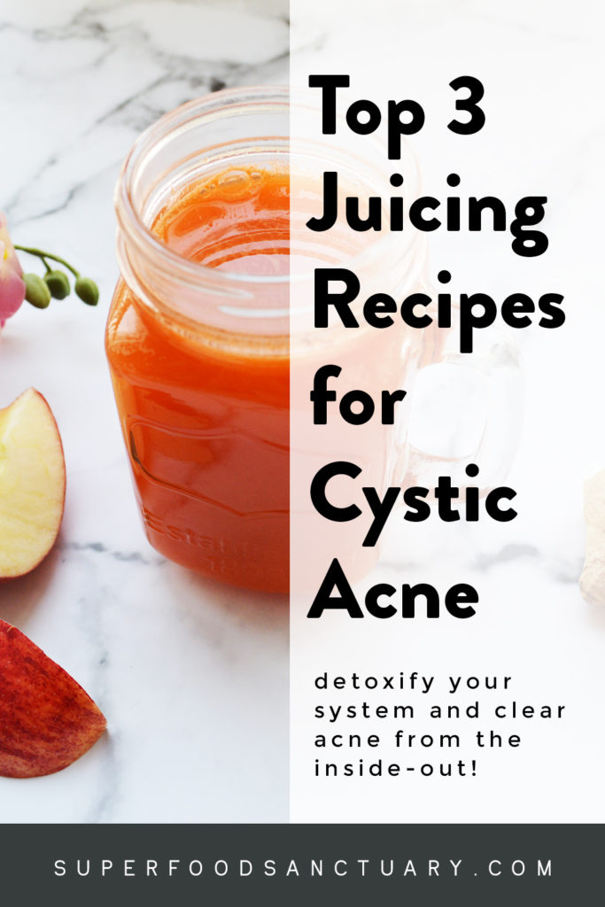 Have you tried any juicing recipes for cystic acne? Who knows, they might be your holy grail that finally gets rid of those painful bumps…